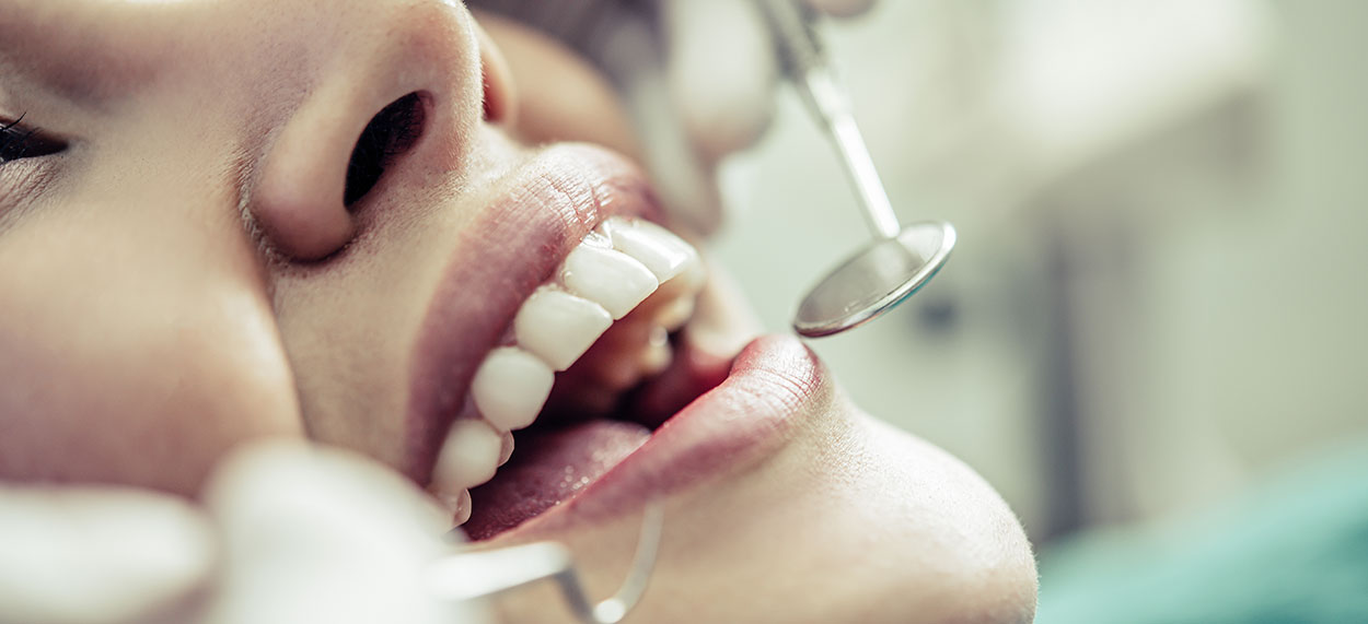 Extracția dentară: măsuri și precauții postextracționale